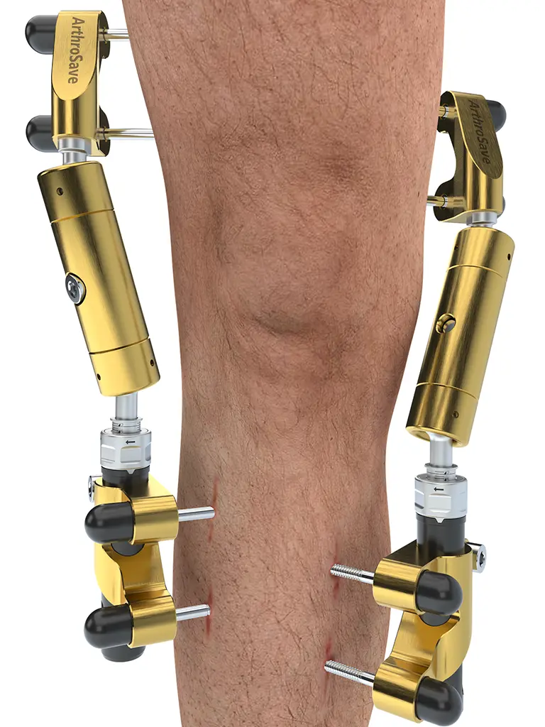 Kniegelenkdistraktion