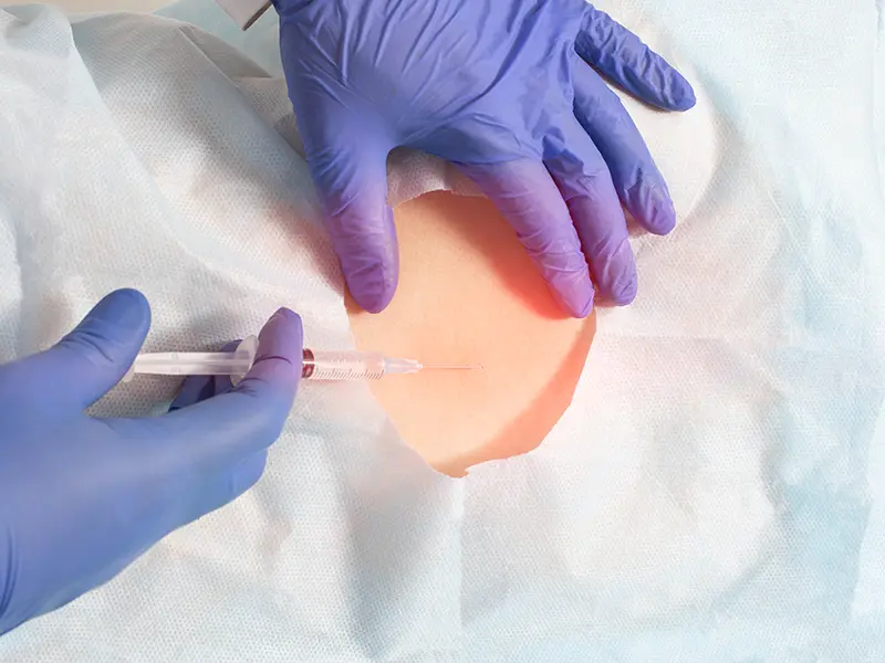 Infiltrationstherapie