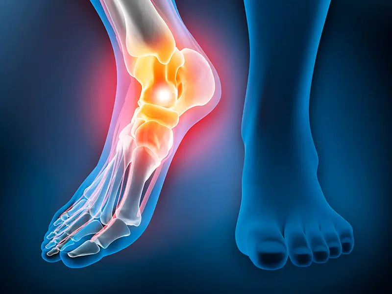 Operative Orthopädie - Sprunggelenk